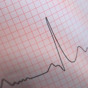 elettrocardiogramma-ecg